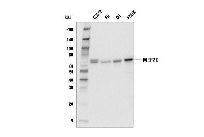 Western Blotting Image 2: MEF2D (E9R5J) Rabbit Monoclonal Antibody