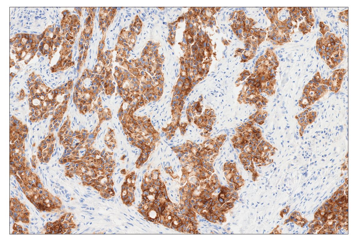 Immunohistochemistry Image 3: FGF Receptor 2IIIb (FPR2-D) Mouse Monoclonal Antibody