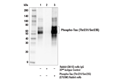 Immunoprecipitation Image 1: Phospho-Tau (Thr231/Ser235) (E7G5W) Rabbit Monoclonal Antibody