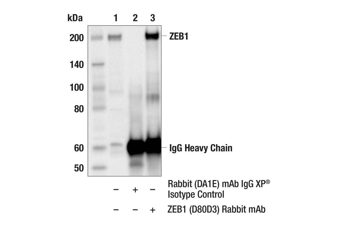 undefined Image 82: Epithelial-Mesenchymal Transition (EMT) Antibody Sampler Kit