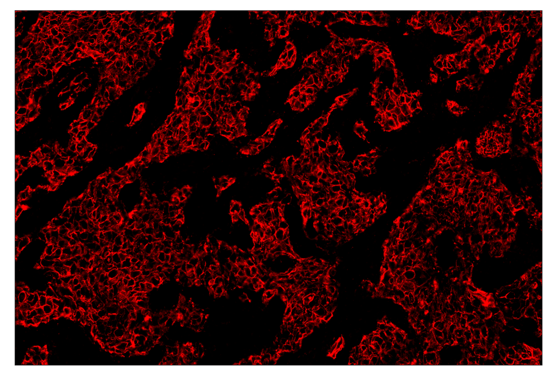 Immunohistochemistry Image 4: HER2/ErbB2 (D8F12) & CO-0059-647 SignalStar<sup>™</sup> Oligo-Antibody Pair
