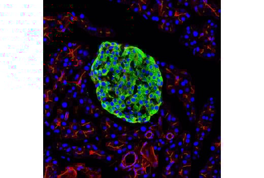 Immunofluorescence Image 1: PC2 (D1E1S) Rabbit Monoclonal Antibody