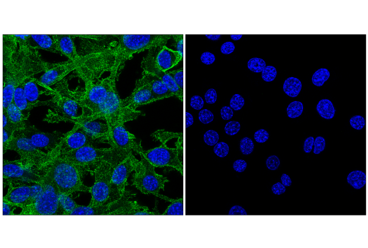 Immunofluorescence Image 1: CD34 (E2J1K) Rabbit Monoclonal Antibody (BSA and Azide Free)