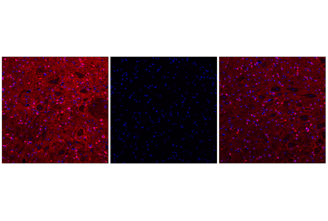Immunofluorescence Image 2: Phospho-Tau (Ser202) (F2A2F) Rabbit Monoclonal Antibody