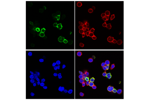 Immunofluorescence Image 2: TIGIT (E5Y1W) Rabbit Monoclonal Antibody (BSA and Azide Free)
