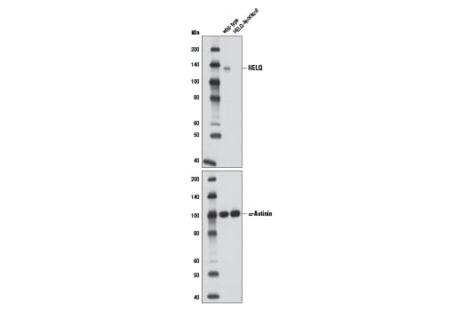 Western Blotting Image 2: HELQ (D4K2O) Rabbit Monoclonal Antibody