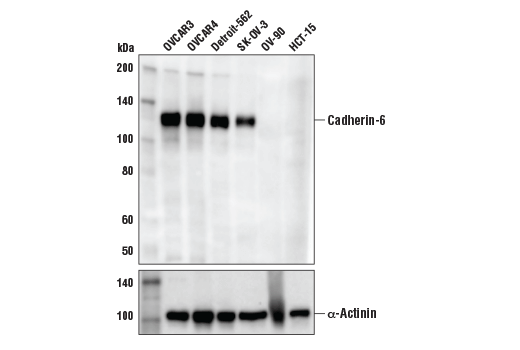 Western Blotting Image 1: Cadherin-6 (D3T3I) Rabbit mAb (BSA and Azide Free)