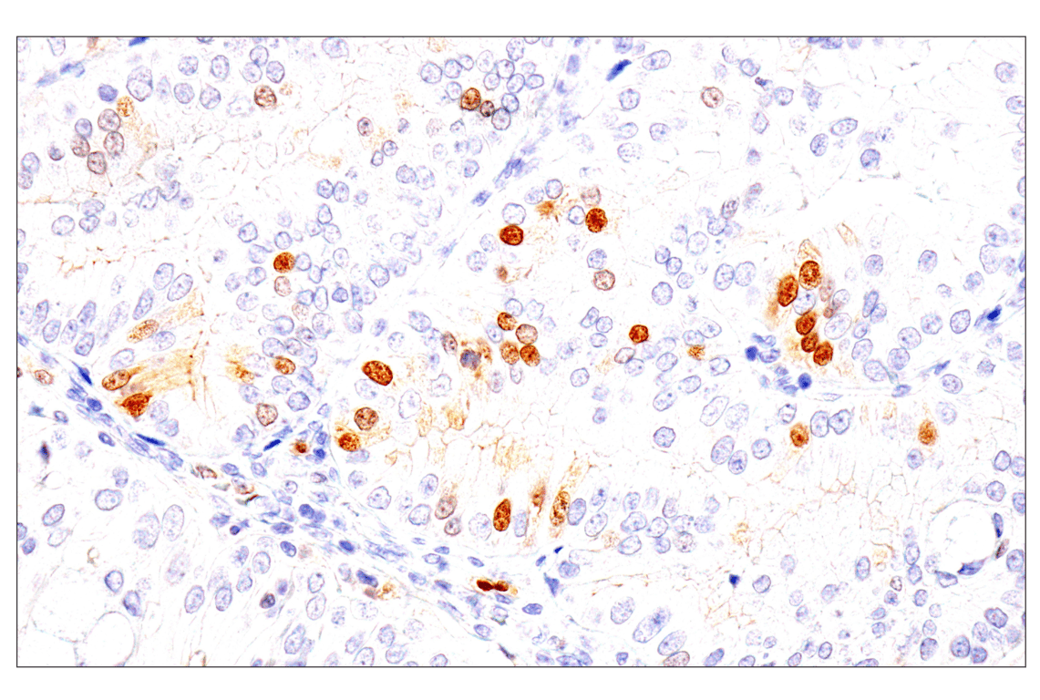 Immunohistochemistry Image 8: Chk1 (2G1D5) Mouse mAb