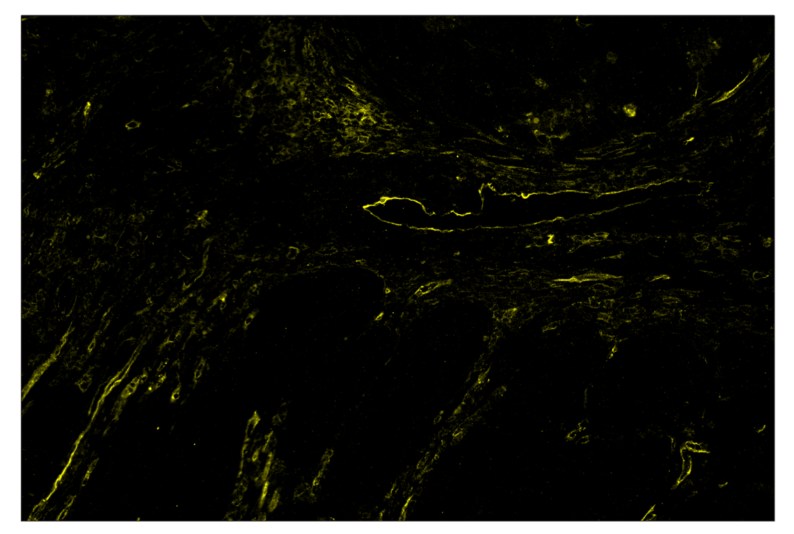 Immunohistochemistry Image 3: CD54/ICAM-1 (E3Q9N) & CO-0146-594 SignalStar<sup>™</sup> Oligo-Antibody Pair