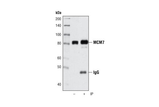 Immunoprecipitation Image 1: MCM7 (D10A11) Rabbit Monoclonal Antibody