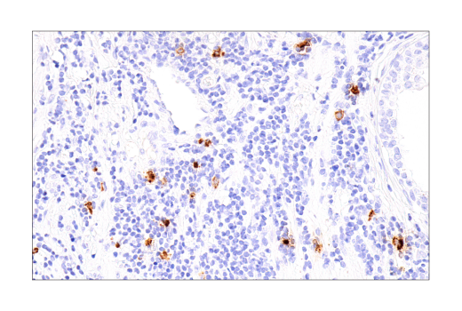 undefined Image 40: NETosis Antibody Sampler Kit