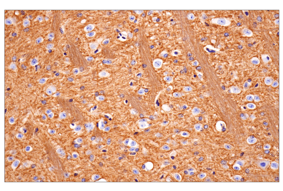 Immunohistochemistry Image 5: CD81 (D5O2Q) Rabbit Monoclonal Antibody