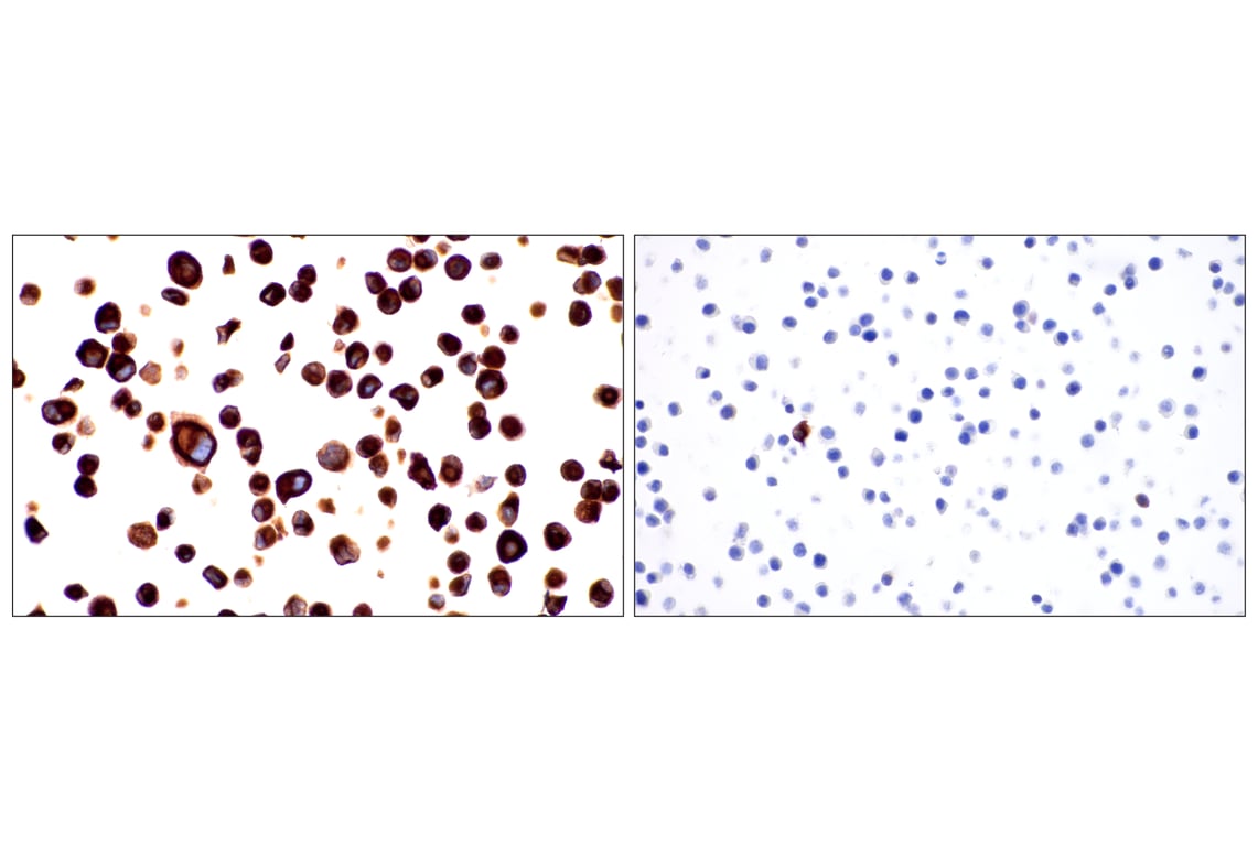 Immunohistochemistry Image 14: Nestin (E5C7I) Rabbit Monoclonal Antibody (BSA and Azide Free)