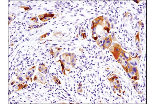 undefined Image 21: Lung Cancer RTK Antibody Sampler Kit