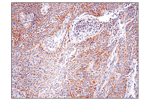 BCAT2 (D8K3O) Rabbit mAb | Cell Signaling Technology