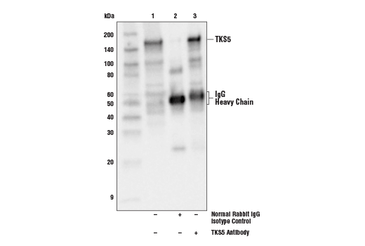 Immunoprecipitation Image 1: TKS5 Antibody