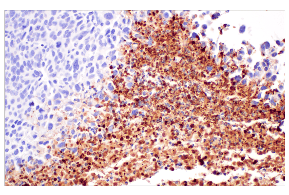 Immunohistochemistry Image 6: Citrullinated Histone H3 (Arg2) (F3C9B) Rabbit Monoclonal Antibody (BSA and Azide Free)