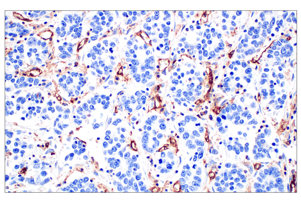 Immunohistochemistry Image 8: CD31 (PECAM-1) (F8M3S) Rabbit Monoclonal Antibody