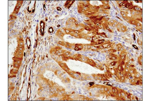 Immunohistochemistry Image 3: ASS1 (D4O4B) Rabbit Monoclonal Antibody