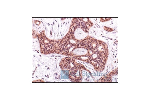 Immunohistochemistry Image 1: Phospho-Akt (Ser473) (736E11) Rabbit Monoclonal Antibody