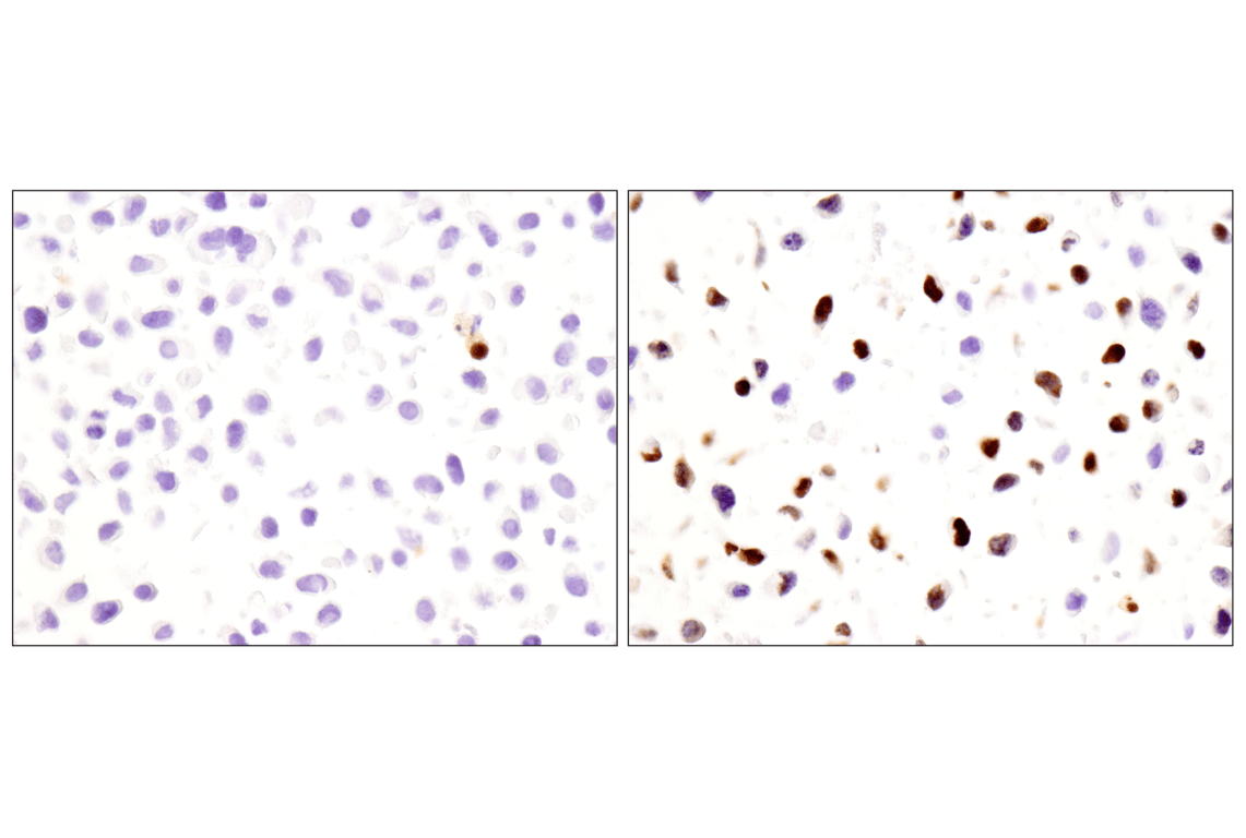 undefined Image 16: Apoptosis Antibody Sampler Kit II