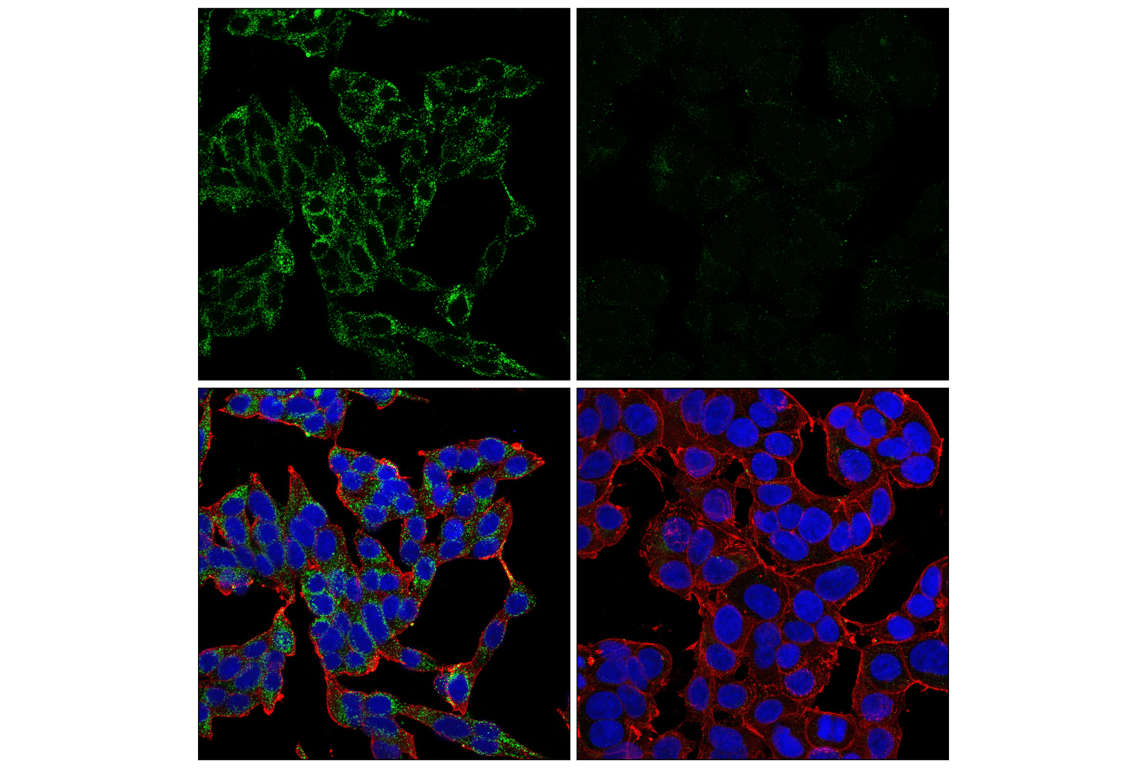 Immunofluorescence Image 1: Mucolipin-1 (F8F9Q) Rabbit Monoclonal Antibody