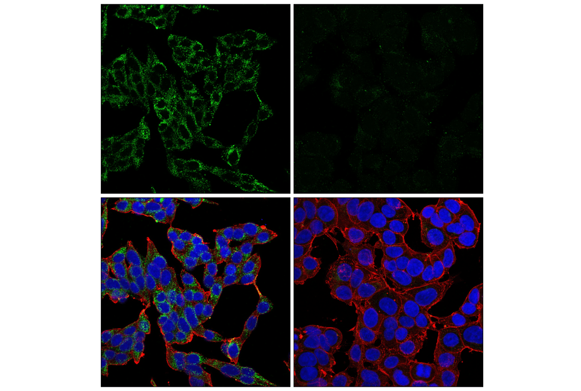 Immunofluorescence Image 1: Mucolipin-1 (F8F9Q) Rabbit mAb