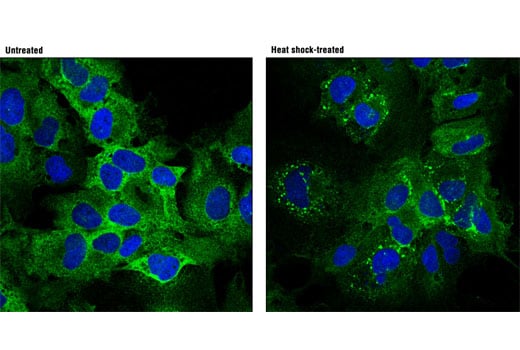 Immunofluorescence Image 1: UPF1 (D15G6) Rabbit Monoclonal Antibody