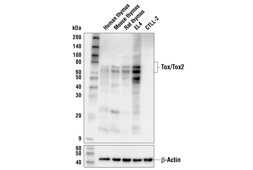 Western Blotting Image 2: Tox/Tox2 (E6G5O) Rabbit Monoclonal Antibody (BSA and Azide Free)