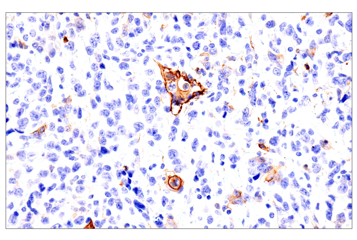 Immunohistochemistry Image 15: p75NTR (E7I3M) Rabbit Monoclonal Antibody (BSA and Azide Free)