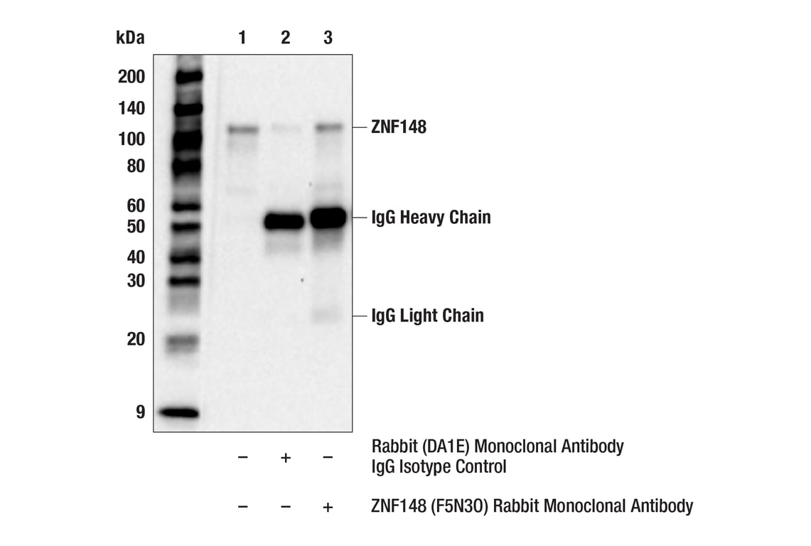 Immunoprecipitation Image 1: ZNF148 (F5N3O) Rabbit Monoclonal Antibody