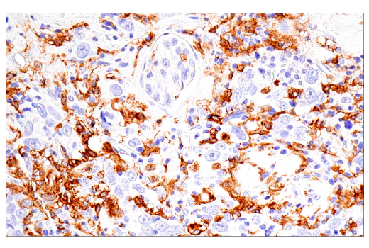 Immunohistochemistry Image 1: CD16 (2H7) Mouse Monoclonal Antibody