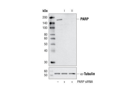 undefined Image 1: SignalSilence<sup>®</sup> PARP siRNA I