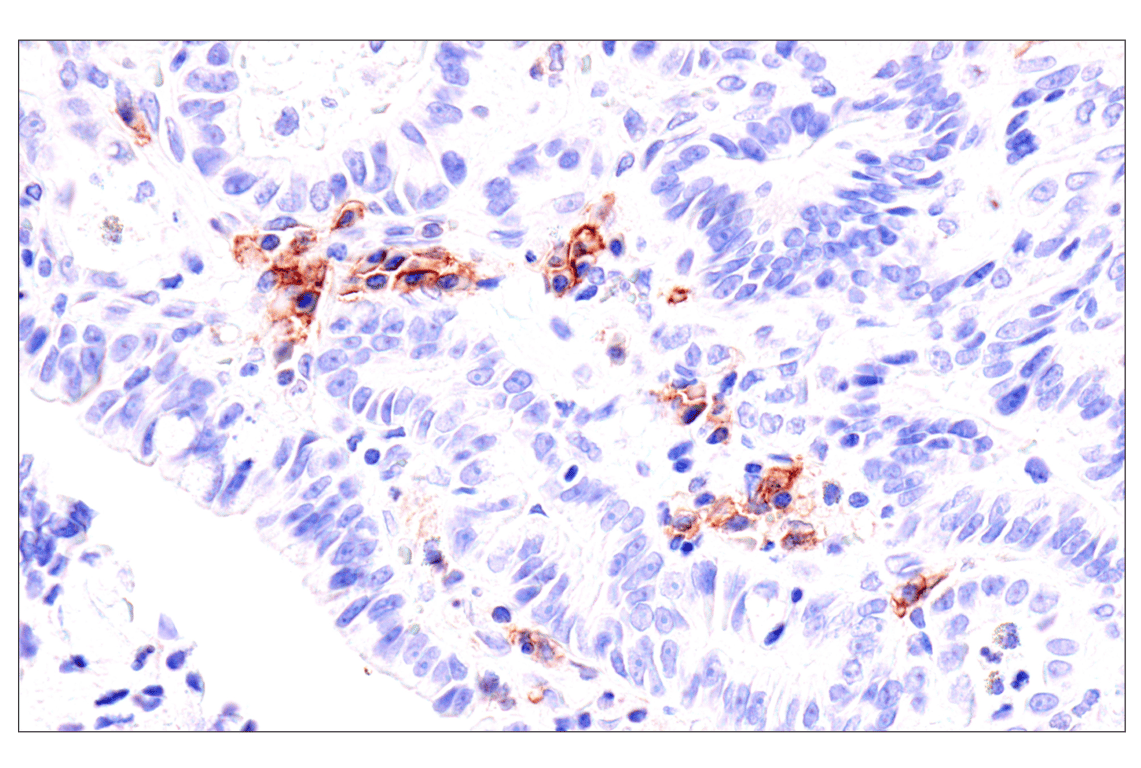 Immunohistochemistry Image 6: Semaphorin-4A (E5N3K) Rabbit Monoclonal Antibody (BSA and Azide Free)