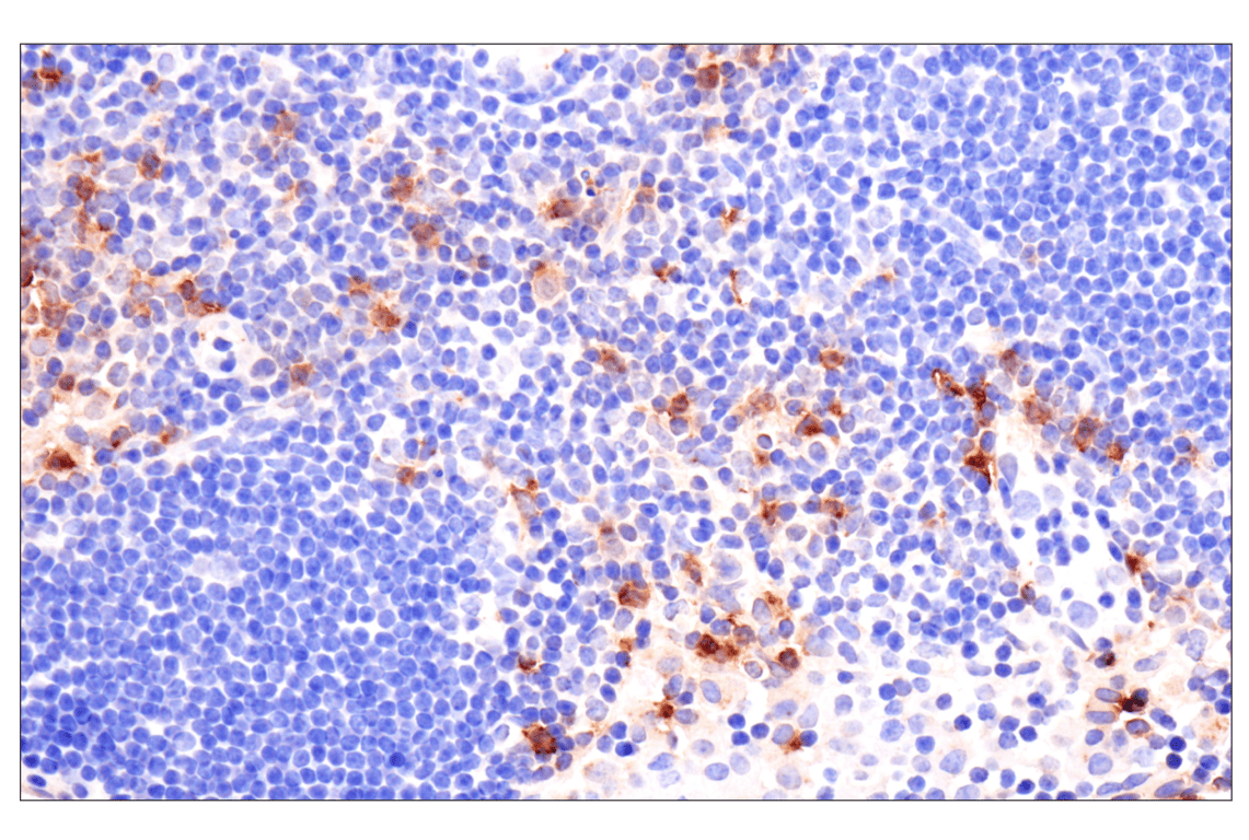 Immunohistochemistry Image 4: Eosinophil cationic protein (F3G7N) Rabbit Monoclonal Antibody