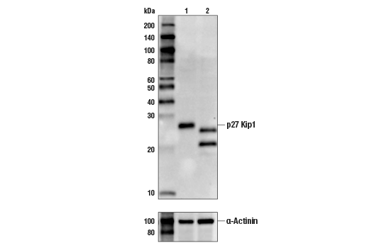 Western Blotting Image 1: p27 Kip1 (SX53G8.5) Mouse mAb