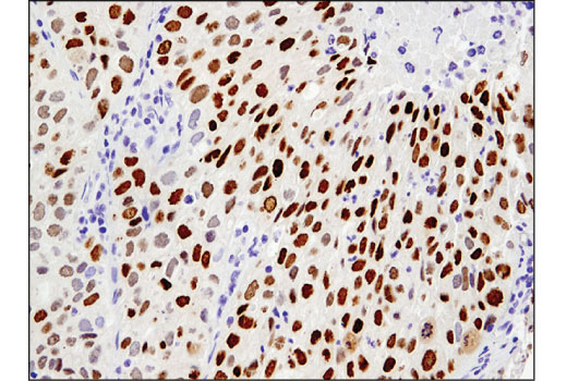 Immunohistochemistry Image 1: SIX1 (D5S2S) Rabbit Monoclonal Antibody