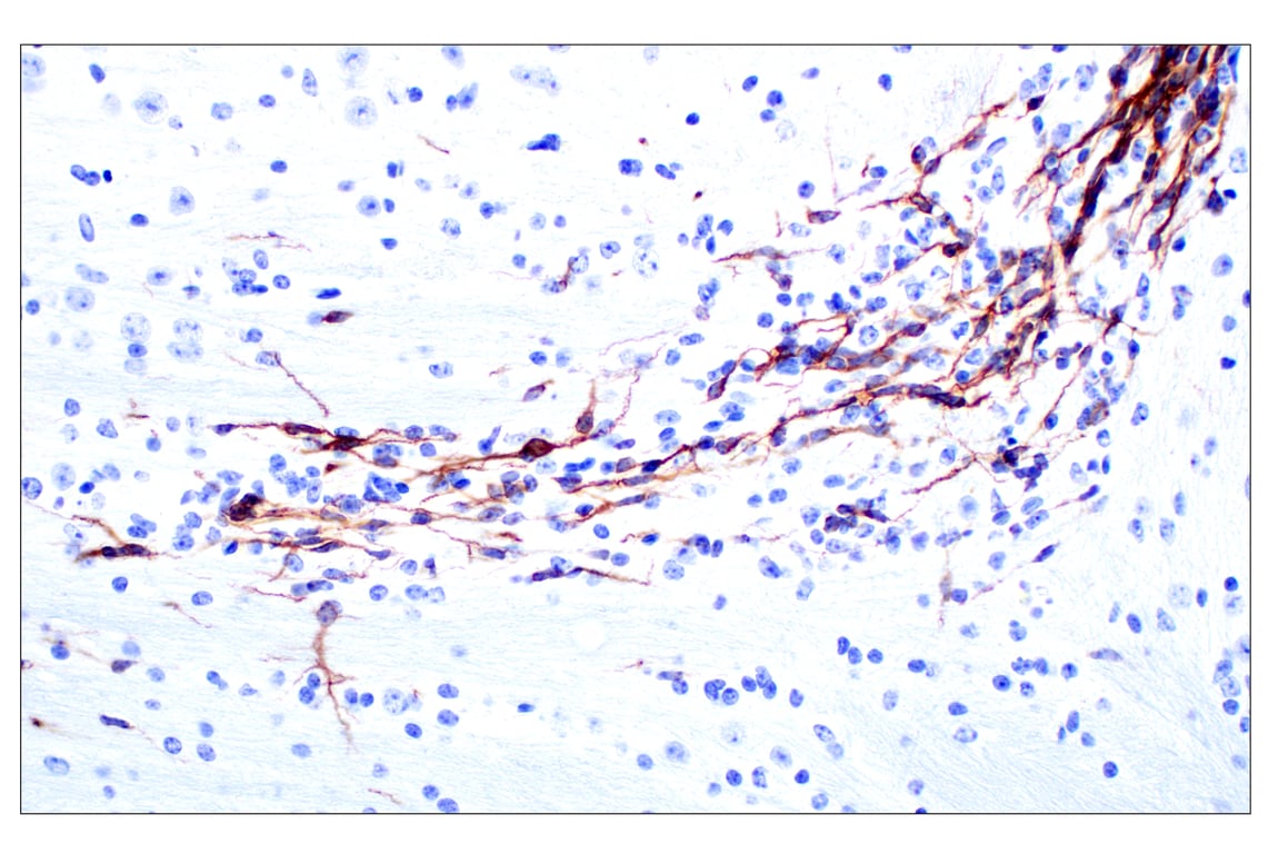 Immunohistochemistry Image 2: Doublecortin (E3S7L) Rabbit Monoclonal Antibody