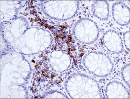 Immunohistochemical analysis of paraffin-embedded human tonsil using CD19 (Intracellular Domain) (D4V4B) XP<sup>®</sup> Rabbit mAb.