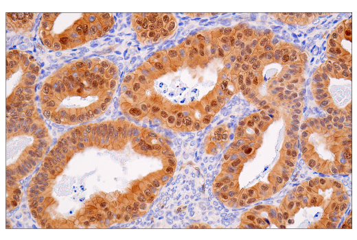 Immunohistochemistry Image 8: beta-Catenin (15B8) Mouse Monoclonal Antibody