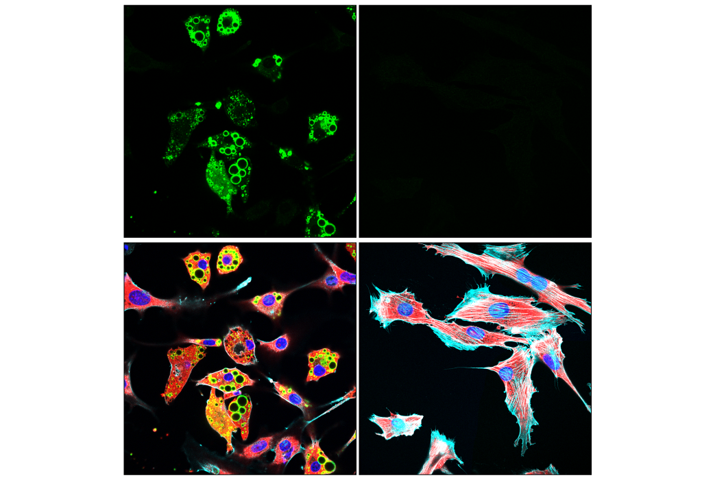 Immunofluorescence Image 1: Perilipin-1 (D1D8) Rabbit Monoclonal Antibody (Alexa Fluor<sup>®</sup> 488 Conjugate)