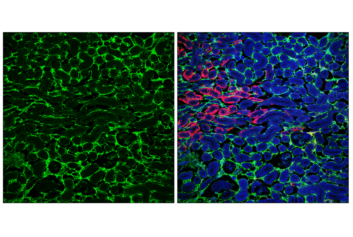 Immunofluorescence Image 2: COL6A1 (E9U3B) Rabbit Monoclonal Antibody