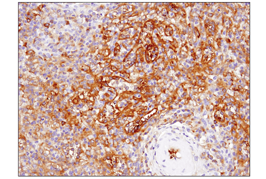 Immunohistochemistry Image 4: IFIT1 (D2X9Z) Rabbit Monoclonal Antibody