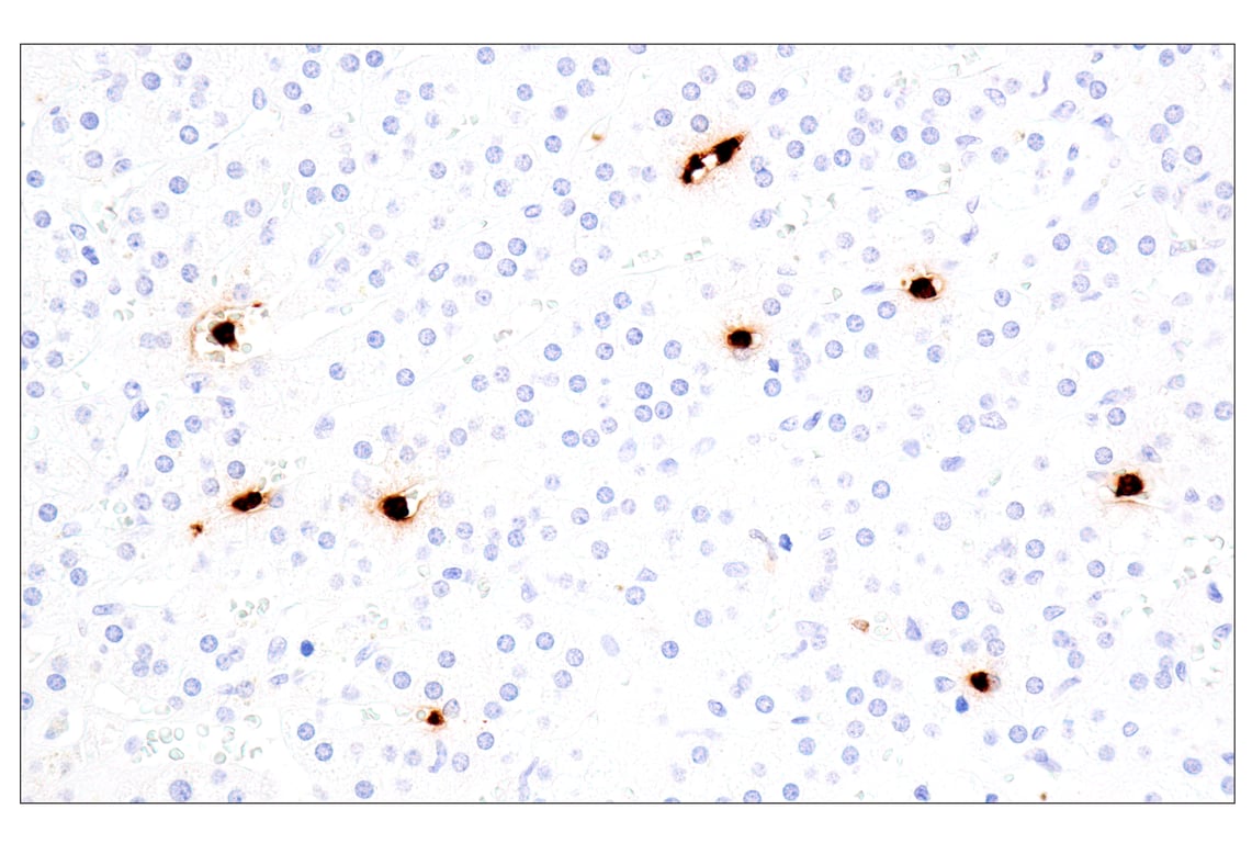 Immunohistochemistry Image 13: Eosinophil cationic protein (E6U5M) Rabbit Monoclonal Antibody