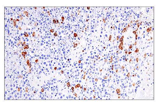 Immunohistochemistry Image 7: HLA-DRA (E9R2Q) XP<sup>®</sup> Rabbit mAb (BSA and Azide Free)