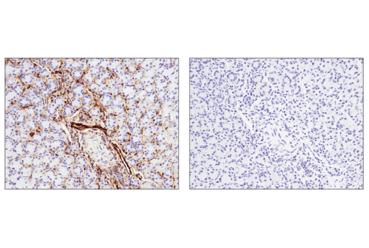 Immunohistochemistry Image 2: CD39/NTPDase 1 (E2X6B) Rabbit Monoclonal Antibody (BSA and Azide Free)