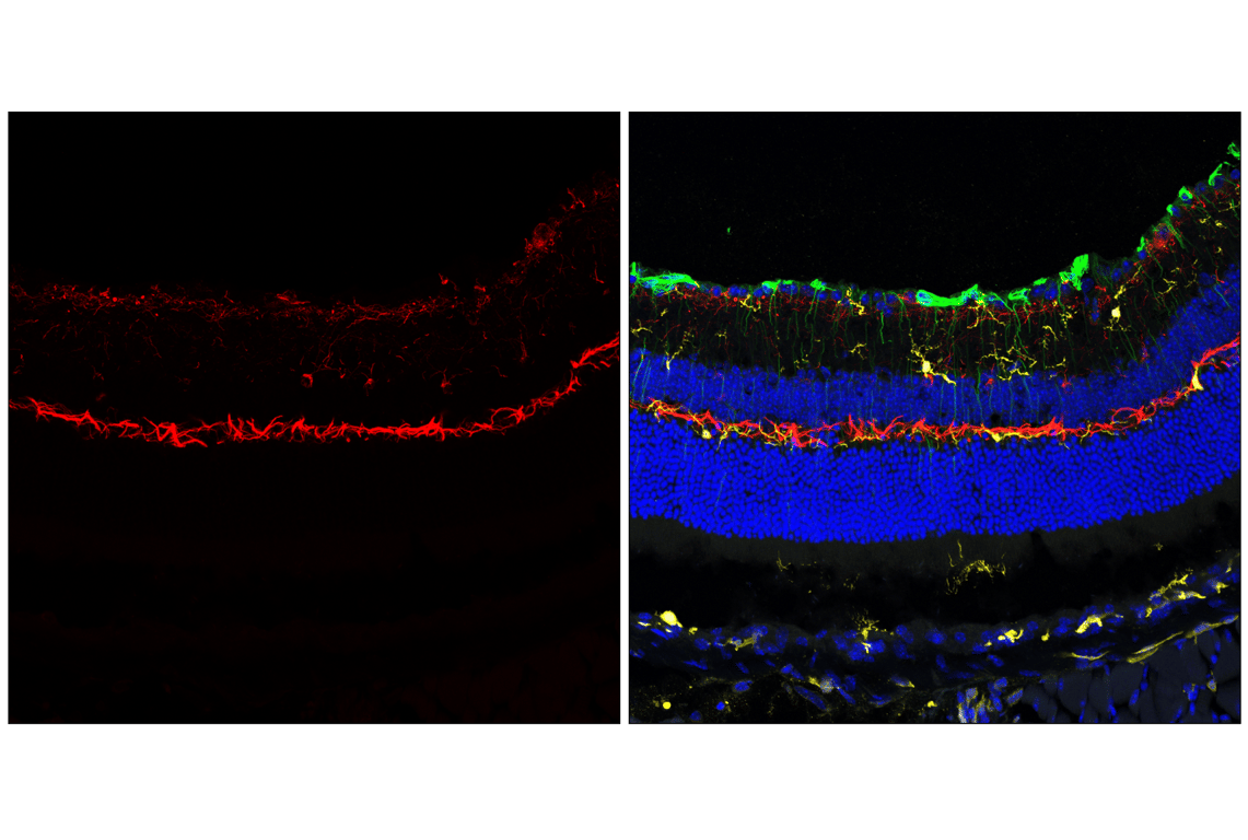 Immunofluorescence Image 3: Neurofilament-H (E7Z7G) Rabbit Monoclonal Antibody (BSA and Azide Free)