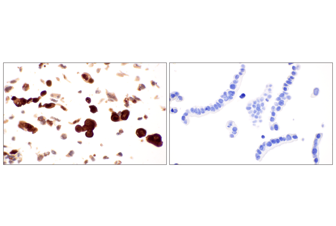 Immunohistochemistry Image 12: MTAP (E5R1I) Rabbit Monoclonal Antibody