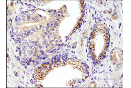 Immunohistochemistry Image 2: EphB2 (D2X2I) Rabbit Monoclonal Antibody