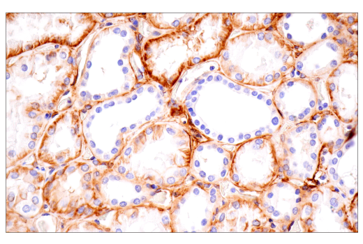 Immunohistochemistry Image 2: Integrin alpha1/CD49a (E9K2J) Rabbit Monoclonal Antibody (BSA and Azide Free)